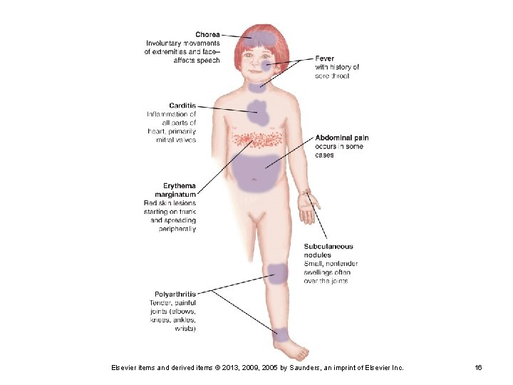 Elsevier items and derived items © 2013, 2009, 2005 by Saunders, an imprint of