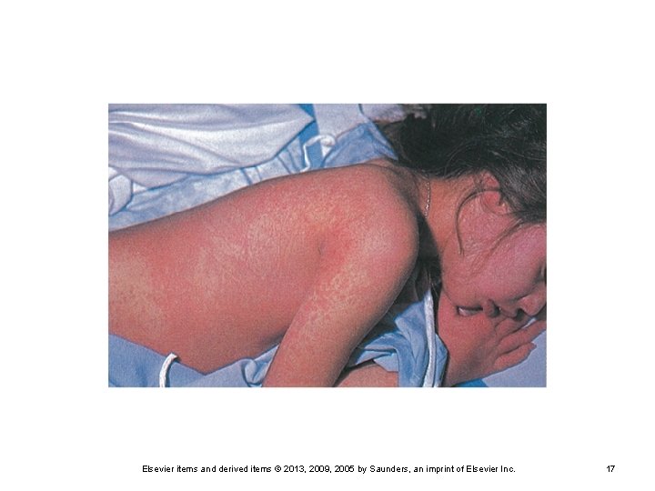 Elsevier items and derived items © 2013, 2009, 2005 by Saunders, an imprint of