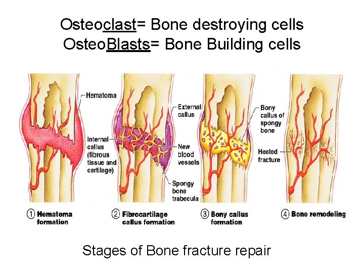Osteoclast= Bone destroying cells Osteo. Blasts= Bone Building cells Stages of Bone fracture repair