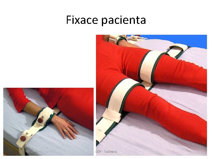 Fixace pacienta OŠP - Točíková 