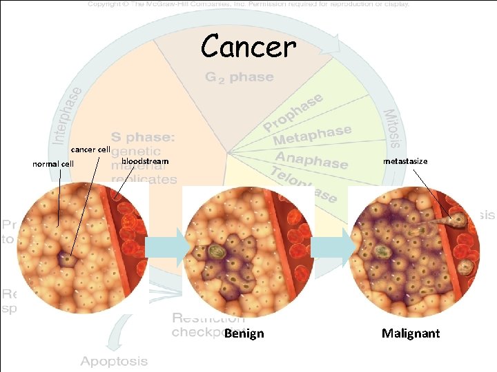 Cancer cell normal cell bloodstream metastasize Benign Malignant 