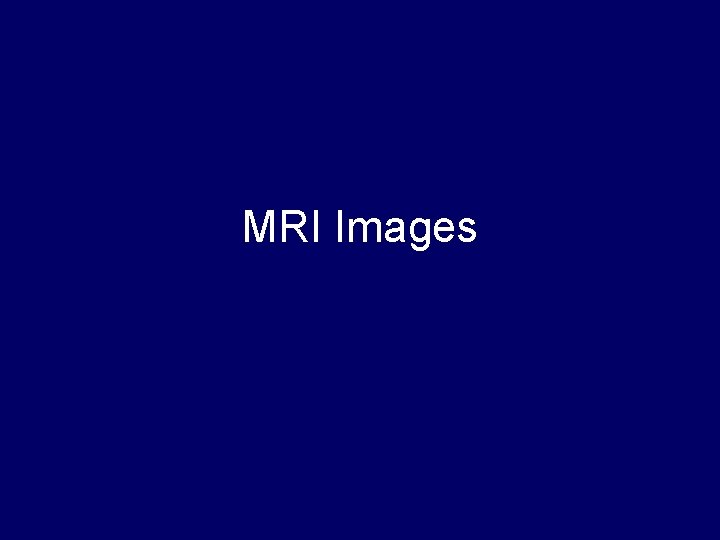 MRI Images 