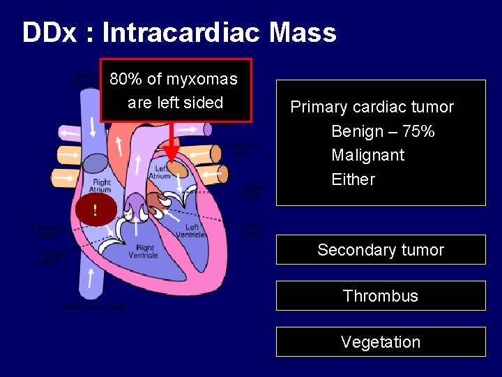 DDx : Intracardiac Mass 80% of myxomas are left sided Primary cardiac tumor Benign