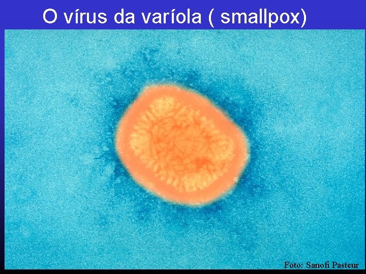 O vírus da varíola ( smallpox) Foto: Sanofi Pasteur 