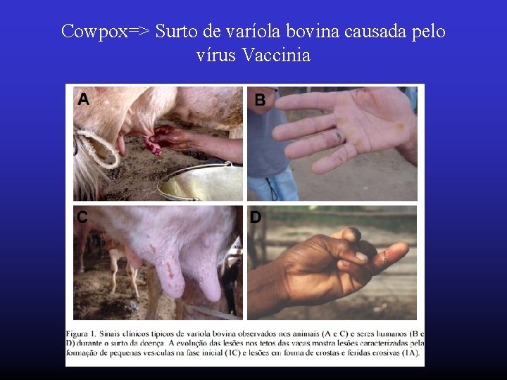 Cowpox=> Surto de varíola bovina causada pelo vírus Vaccinia 