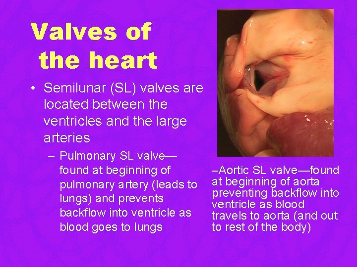 Valves of the heart • Semilunar (SL) valves are located between the ventricles and Valves of the heart • Semilunar (SL) valves are located between the ventricles and