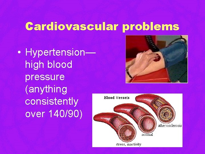 Cardiovascular problems • Hypertension— high blood pressure (anything consistently over 140/90) Cardiovascular problems • Hypertension— high blood pressure (anything consistently over 140/90)