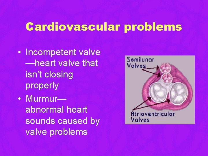 Cardiovascular problems • Incompetent valve —heart valve that isn’t closing properly • Murmur— abnormal Cardiovascular problems • Incompetent valve —heart valve that isn’t closing properly • Murmur— abnormal