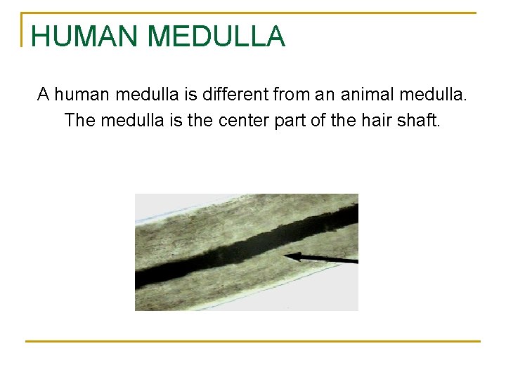 HUMAN MEDULLA A human medulla is different from an animal medulla. The medulla is