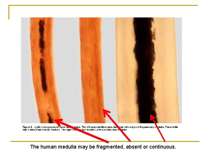 The human medulla may be fragmented, absent or continuous. 