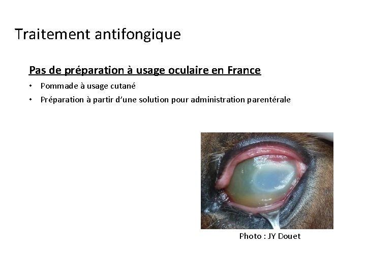 Traitement antifongique Pas de préparation à usage oculaire en France • Pommade à usage