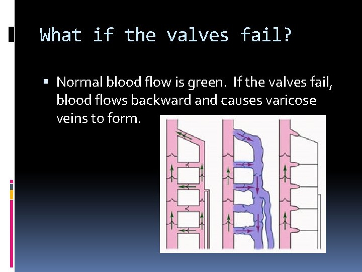 What if the valves fail? Normal blood flow is green. If the valves fail,