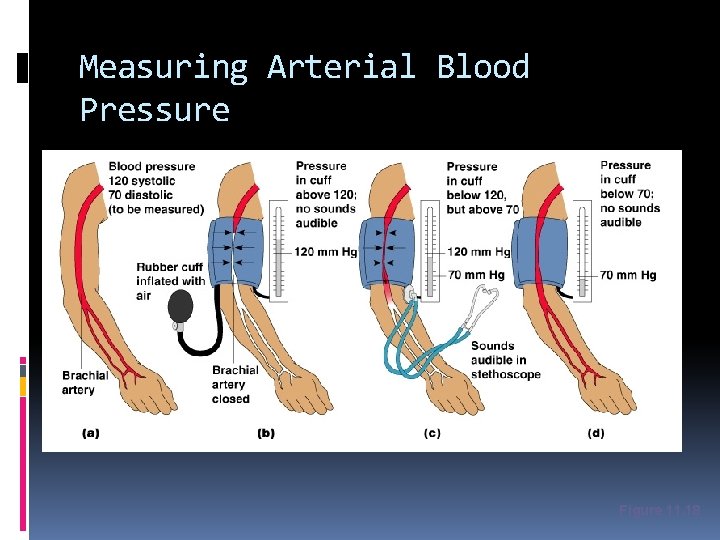 Measuring Arterial Blood Pressure Figure 11. 18 