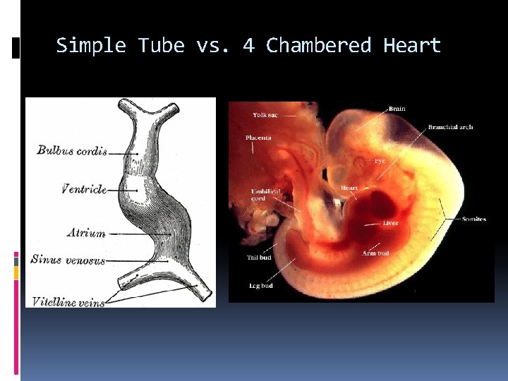 Simple Tube vs. 4 Chambered Heart 