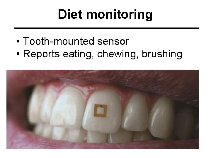 Diet monitoring • Tooth-mounted sensor • Reports eating, chewing, brushing 