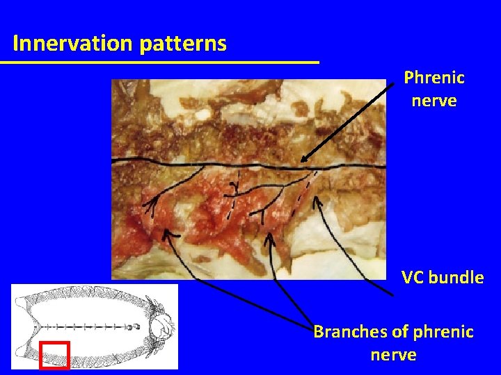 Innervation patterns Phrenic nerve VC bundle Branches of phrenic nerve 