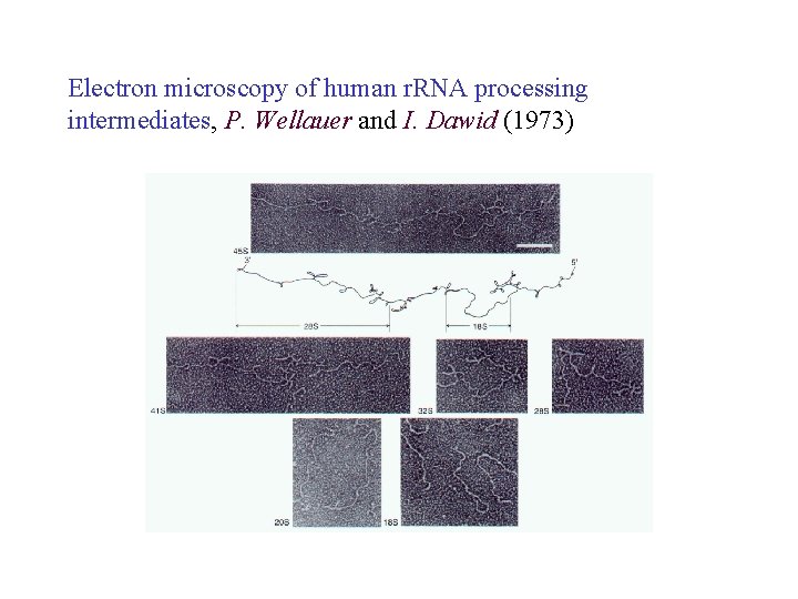 Electron microscopy of human r. RNA processing intermediates, P. Wellauer and I. Dawid (1973)