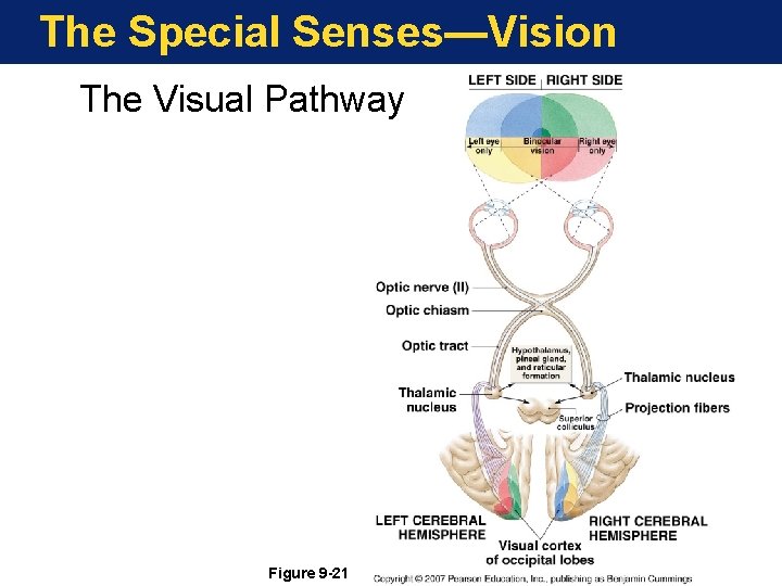 The Special Senses—Vision The Visual Pathway Figure 9 -21 