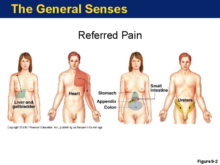 The General Senses Referred Pain Figure 9 -2 