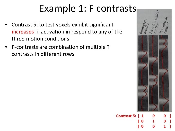 Example 1: F contrasts • Contrast 5: to test voxels exhibit significant increases in