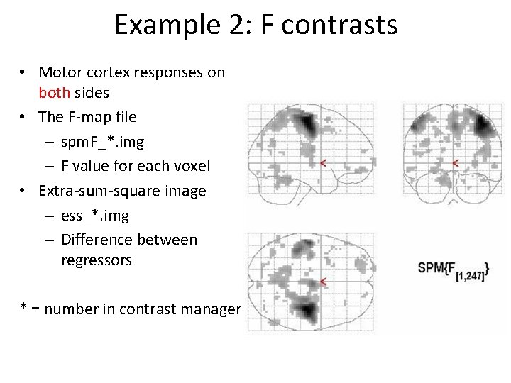 Example 2: F contrasts • Motor cortex responses on both sides • The F-map
