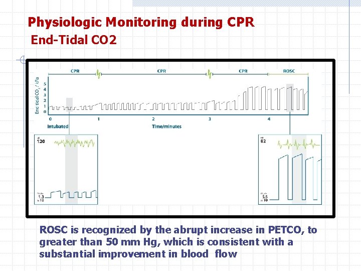 Physiologic Monitoring during CPR End-Tidal CO 2 ROSC is recognized by the abrupt increase