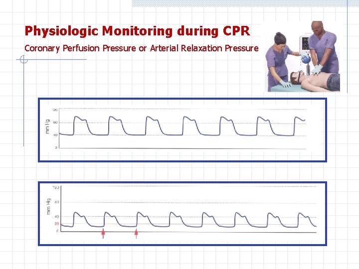 Physiologic Monitoring during CPR Coronary Perfusion Pressure or Arterial Relaxation Pressure 