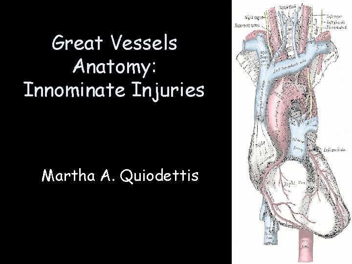 Great Vessels Anatomy: Innominate Injuries Martha A. Quiodettis Great Vessels Anatomy: Innominate Injuries Martha A. Quiodettis