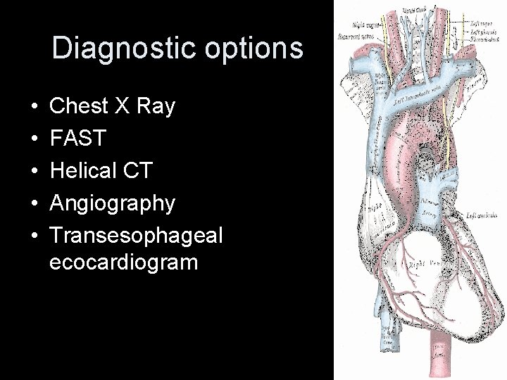 Diagnostic options • • • Chest X Ray FAST Helical CT Angiography Transesophageal ecocardiogram Diagnostic options • • • Chest X Ray FAST Helical CT Angiography Transesophageal ecocardiogram