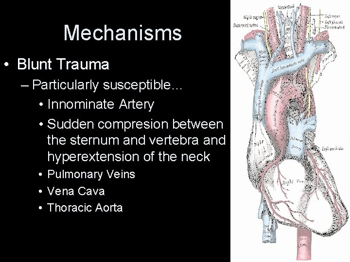 Mechanisms • Blunt Trauma – Particularly susceptible… • Innominate Artery • Sudden compresion between Mechanisms • Blunt Trauma – Particularly susceptible… • Innominate Artery • Sudden compresion between