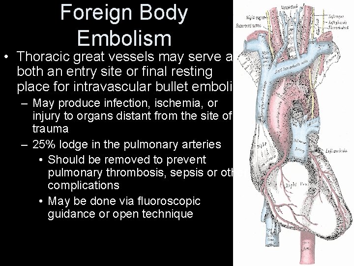 Foreign Body Embolism • Thoracic great vessels may serve as both an entry site Foreign Body Embolism • Thoracic great vessels may serve as both an entry site