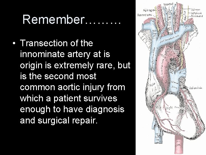 Remember……… • Transection of the innominate artery at is origin is extremely rare, but Remember……… • Transection of the innominate artery at is origin is extremely rare, but