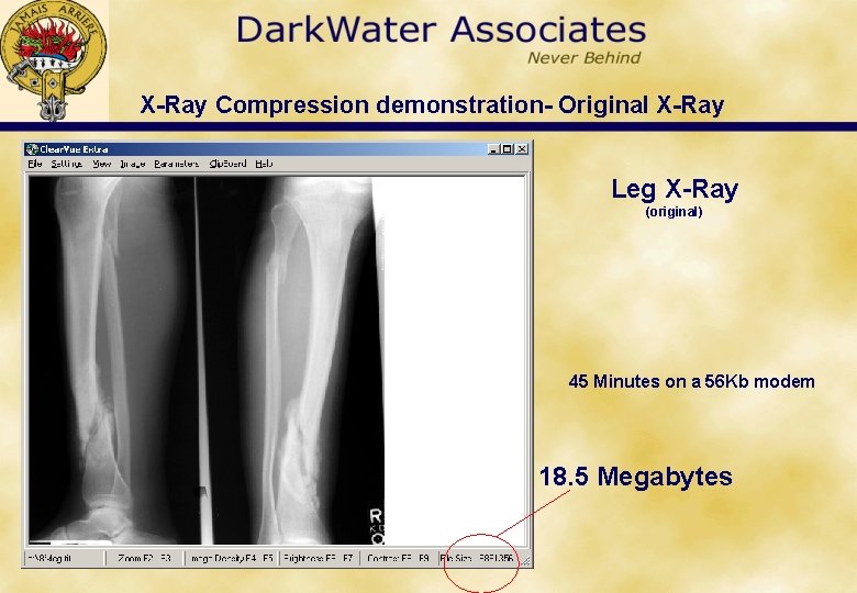 X-Ray Compression demonstration- Original X-Ray Leg X-Ray (original) 45 Minutes on a 56 Kb