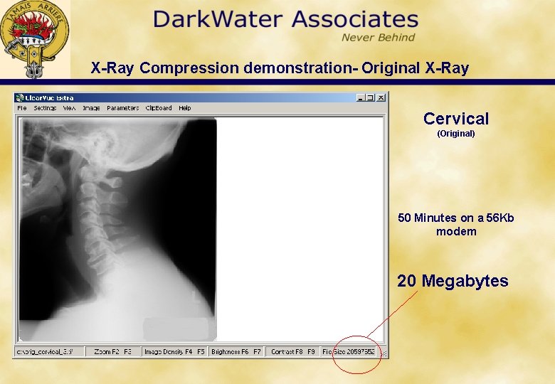 X-Ray Compression demonstration- Original X-Ray Cervical (Original) 50 Minutes on a 56 Kb modem