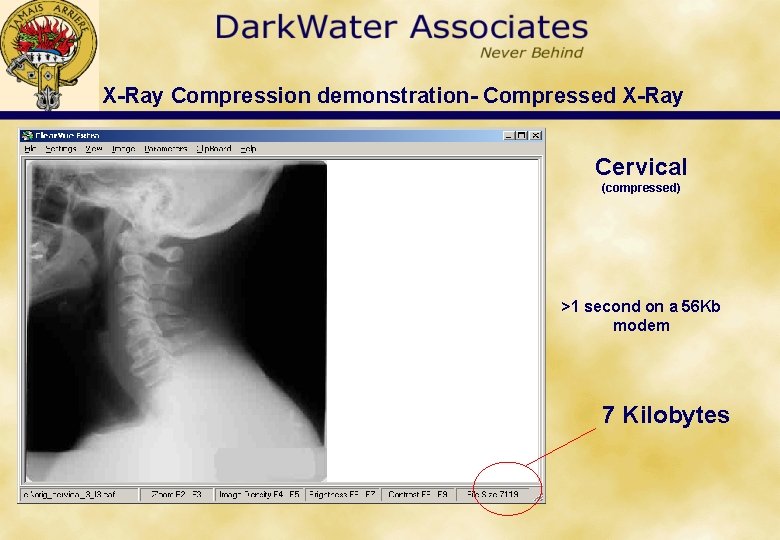 X-Ray Compression demonstration- Compressed X-Ray Cervical (compressed) >1 second on a 56 Kb modem