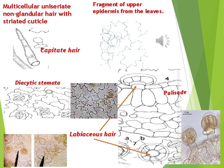 Multicellular uniseriate non-glandular hair with striated cuticle Fragment of upper epidermis from the leaves.