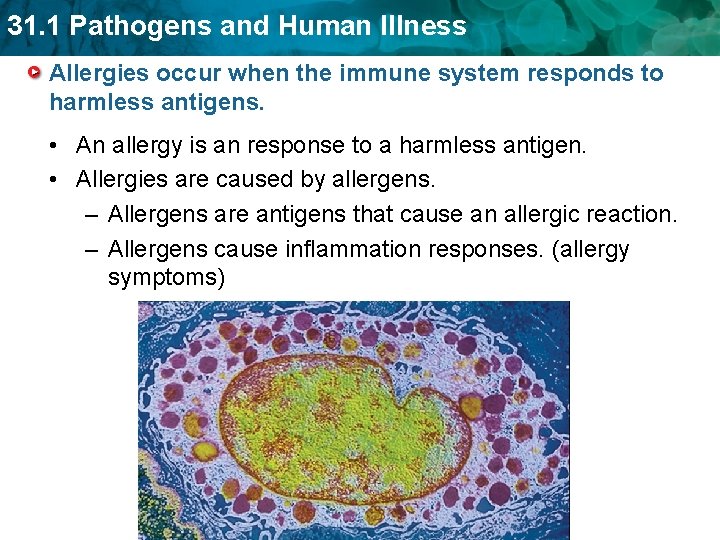 31. 1 Pathogens and Human Illness Allergies occur when the immune system responds to