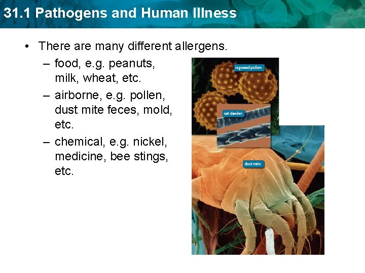 31. 1 Pathogens and Human Illness • There are many different allergens. – food,