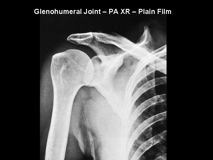Glenohumeral Joint – PA XR – Plain Film 