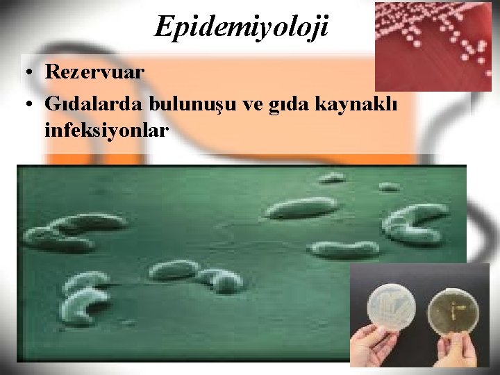 Epidemiyoloji • Rezervuar • Gıdalarda bulunuşu ve gıda kaynaklı infeksiyonlar 