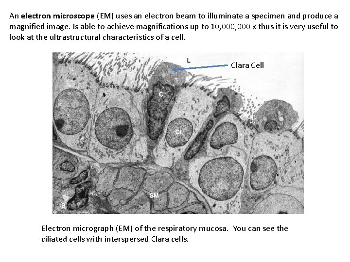 An electron microscope (EM) uses an electron beam to illuminate a specimen and produce