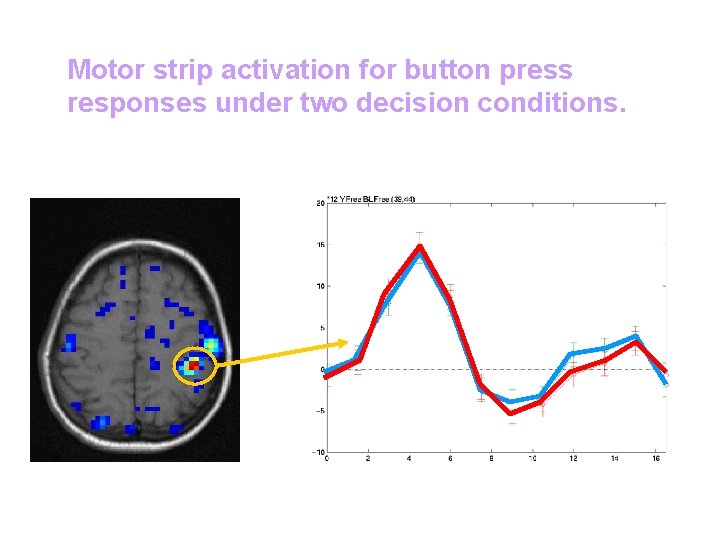 Motor strip activation for button press responses under two decision conditions. 