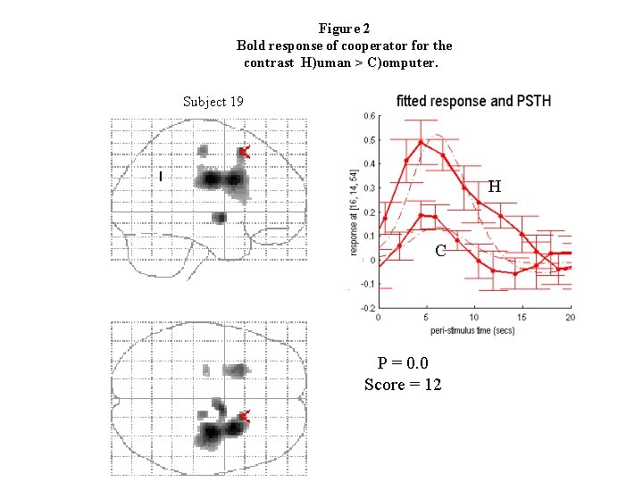 Figure 2 Bold response of cooperator for the contrast H)uman > C)omputer. Subject 19