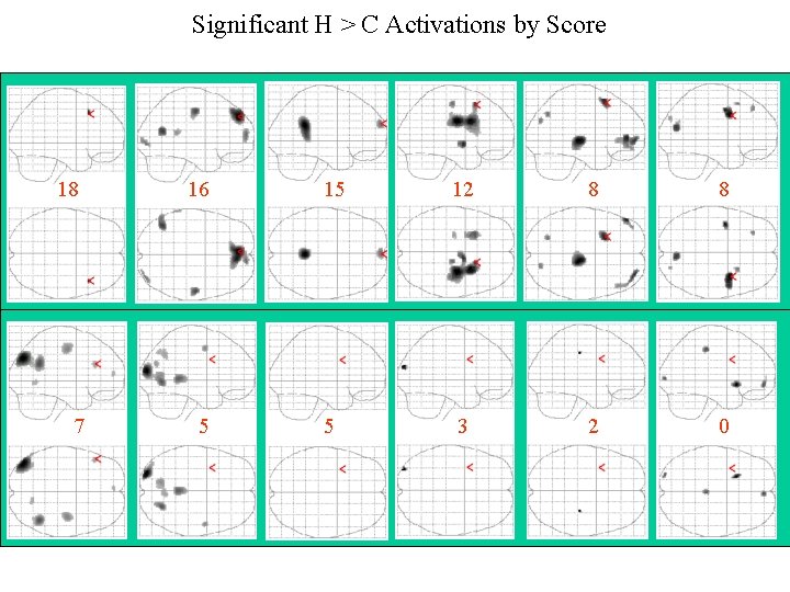 Significant H > C Activations by Score 18 16 15 12 8 8 7