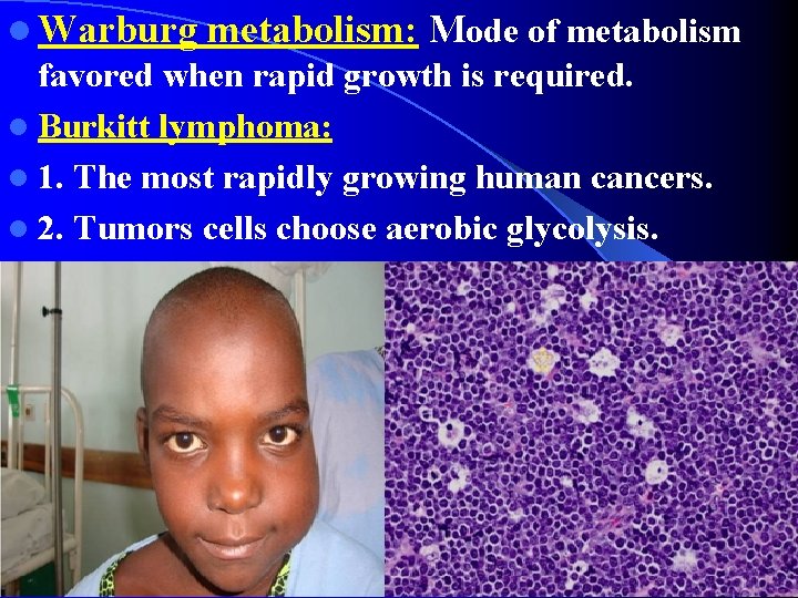 l Warburg metabolism: Mode of metabolism favored when rapid growth is required. l Burkitt