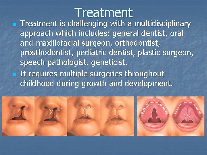 Treatment n n Treatment is challenging with a multidisciplinary approach which includes: general dentist,