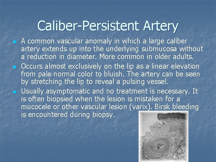 Caliber-Persistent Artery n n n A common vascular anomaly in which a large caliber