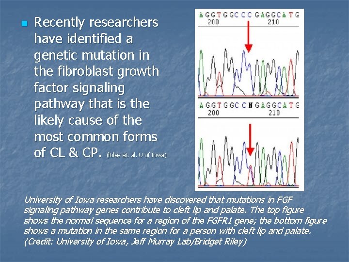 n Recently researchers have identified a genetic mutation in the fibroblast growth factor signaling