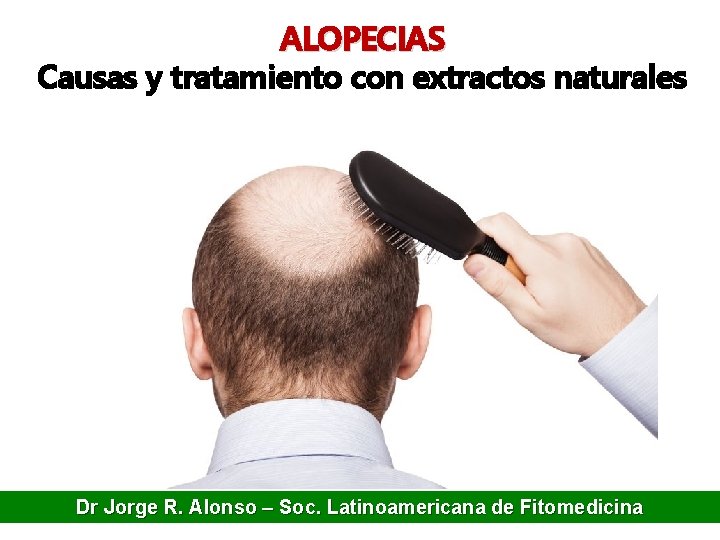 ALOPECIAS Causas y tratamiento con extractos naturales Dr Jorge R. Alonso – Soc. Latinoamericana