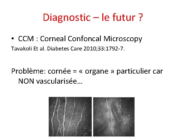 Diagnostic – le futur ? • CCM : Corneal Confoncal Microscopy Tavakoli Et al.